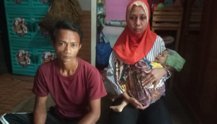 Alami Gizi Buruk, Bayi Asal Cikembar Sukabumi Dirawat di RSUD R Syamsudin SH