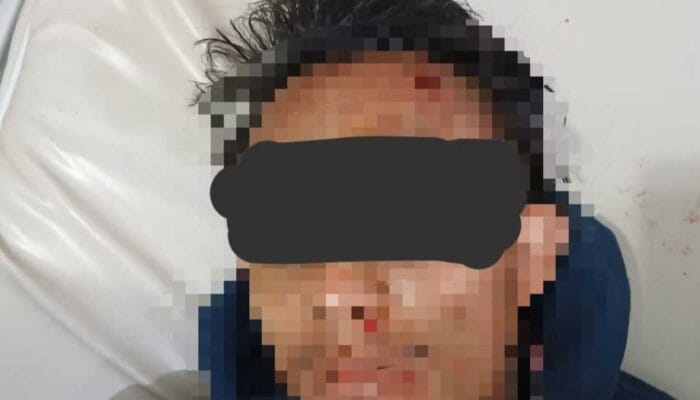 Pencuri Sepeda Motor di Campaka Purwakarta Tabrakan Lalu Diringkus