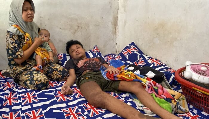 Kadinkes Kab. Sukabumi Angkat Bicara Terkait Abi Remaja Asal Sukaraja Menderita Penyakit Langka