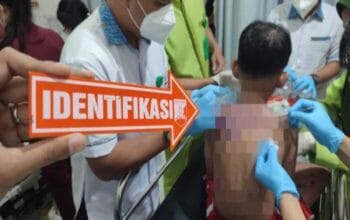 Ibu & Anak di Baros Kota Sukabumi Disiram Air Keras OTK, Polisi Buru Pelaku