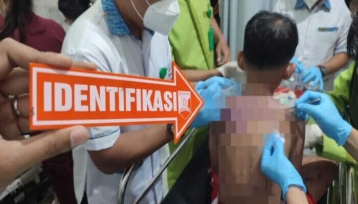 Ibu & Anak di Baros Kota Sukabumi Disiram Air Keras OTK, Polisi Buru Pelaku