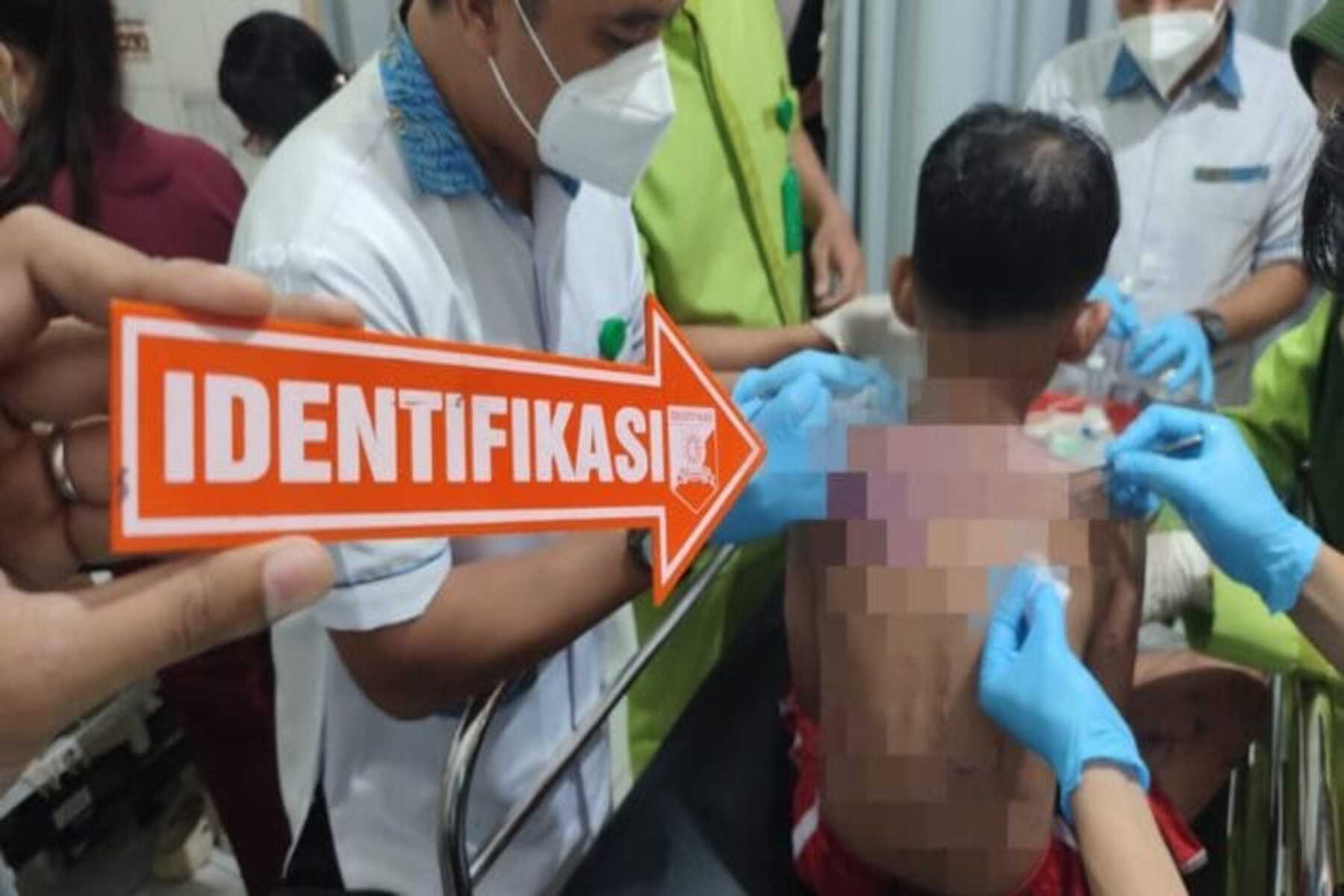 Ibu & Anak di Baros Kota Sukabumi Disiram Air Keras OTK, Polisi Buru Pelaku