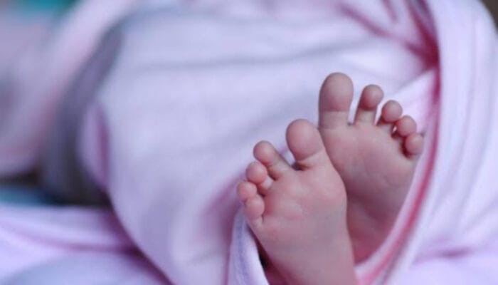 Mengenal Atresia Duodenum