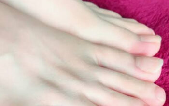 Pembengkakan Kaki Tanda Jantung Anda Butuh Perhatian