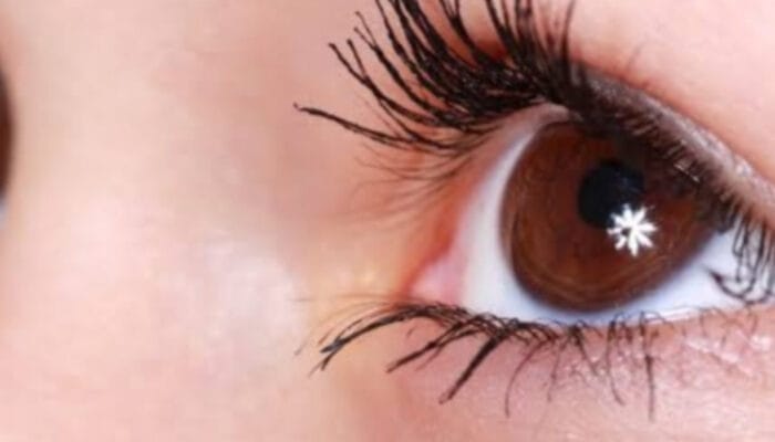 Pupil Mata Beda Ukuran? Kenali Anisokor, dari yang Normal Hingga Tanda Bahaya