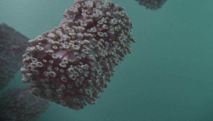 Mengenal Tahapan Cacar Air: Dari Infeksi Hingga Sembuh