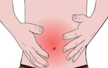 Panduan Mengatasi Sakit Perut Setelah Makan Pedas