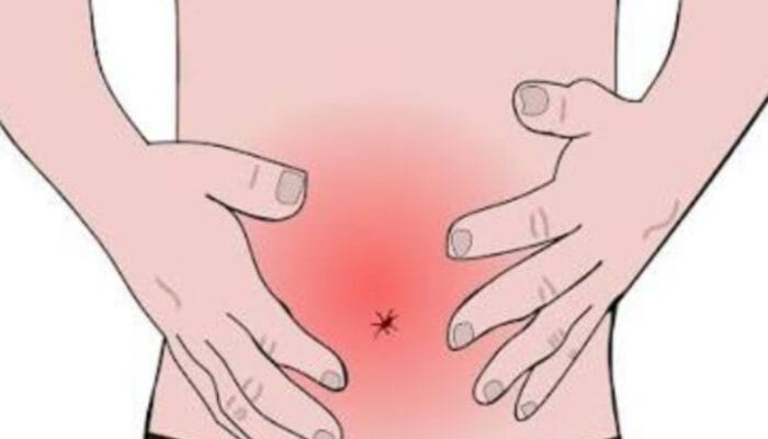 Panduan Mengatasi Sakit Perut Setelah Makan Pedas