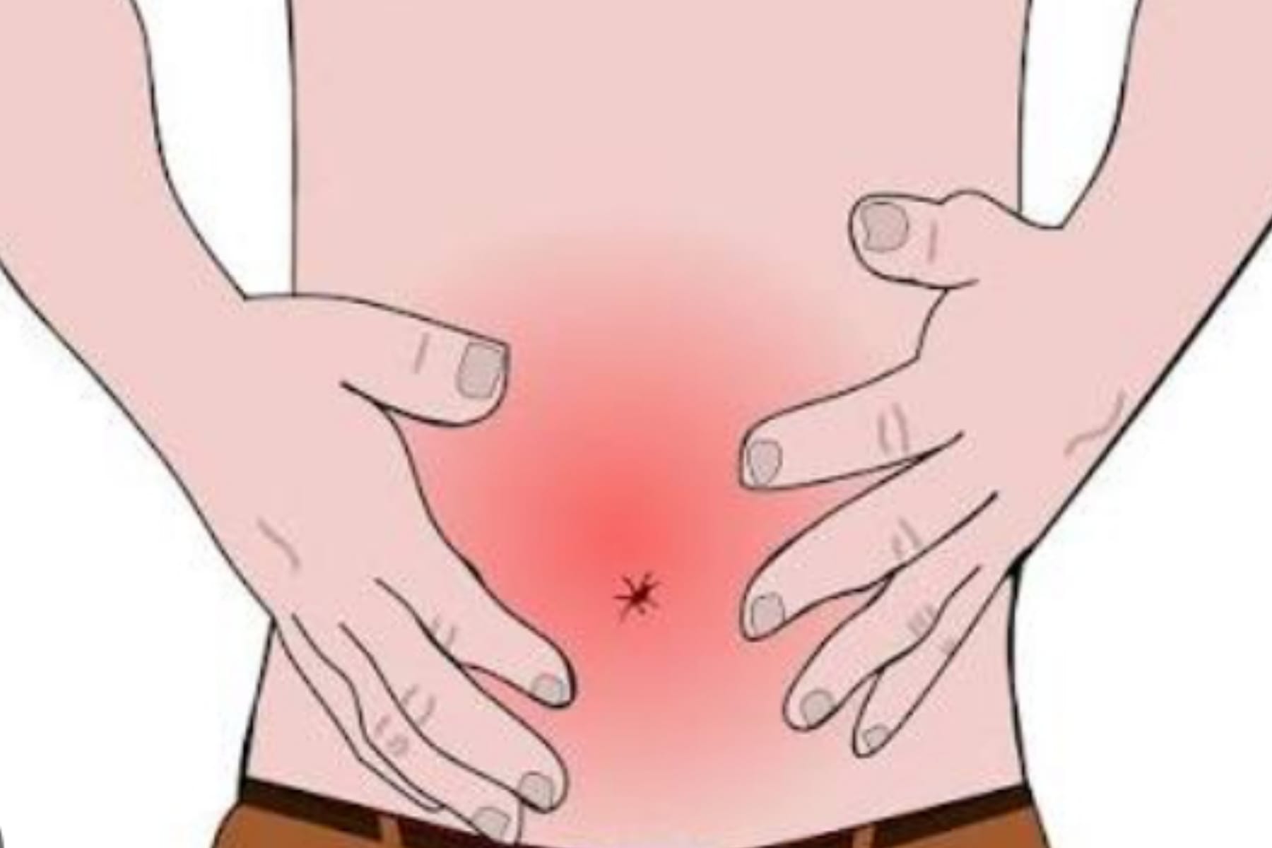 Panduan Mengatasi Sakit Perut Setelah Makan Pedas 1 Panduan Mengatasi Sakit Perut Setelah Makan Pedas