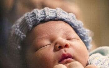 Bibir Anak Bengkak Tiba-Tiba? Kenali Penyebab dan Penanganannya