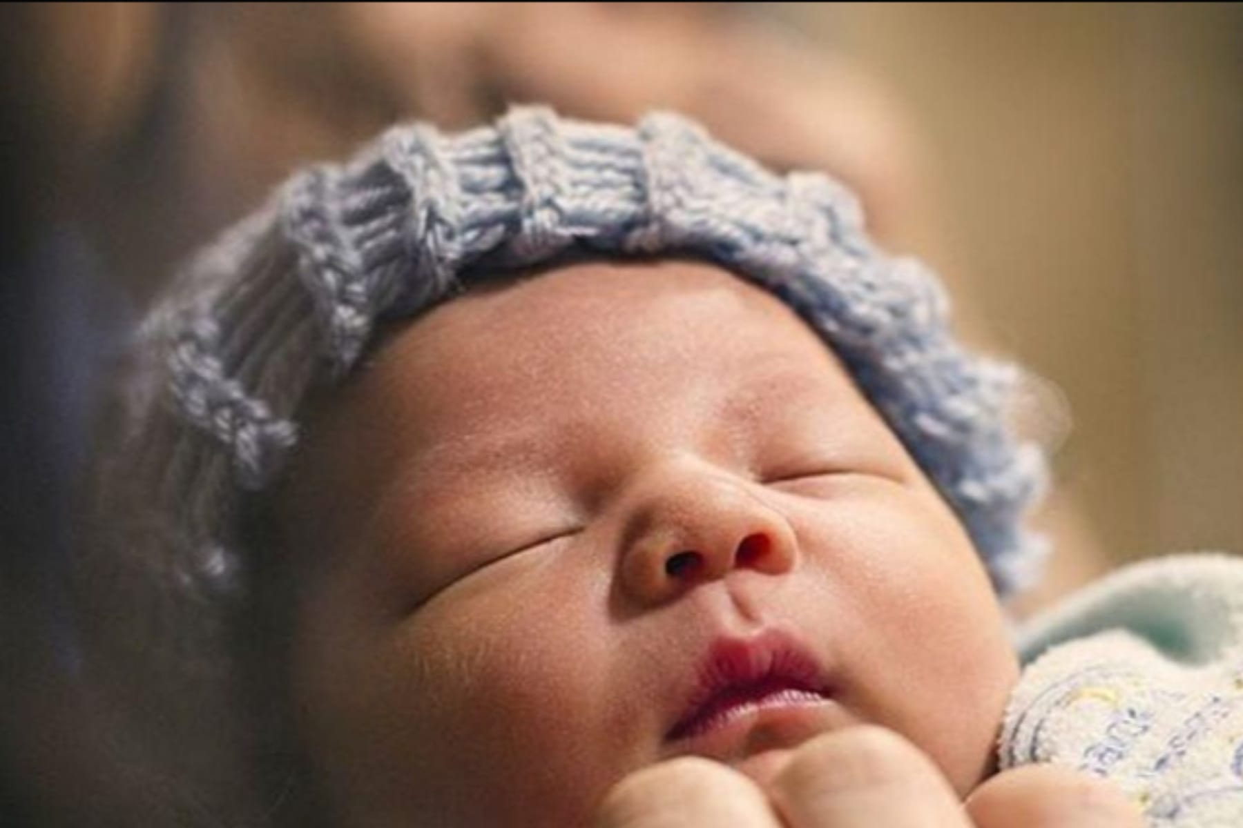 Bibir Anak Bengkak Tiba-Tiba? Kenali Penyebab dan Penanganannya