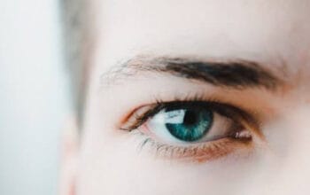 Cara Ampuh Mengatasi Ketombe Alis yang Mengganggu