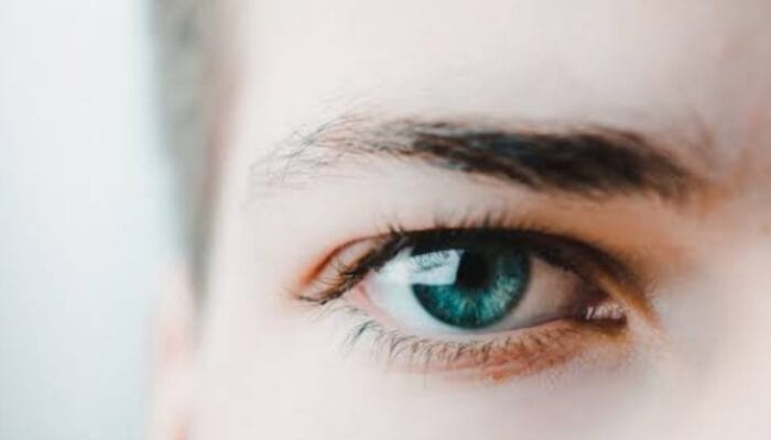 Cara Ampuh Mengatasi Ketombe Alis yang Mengganggu