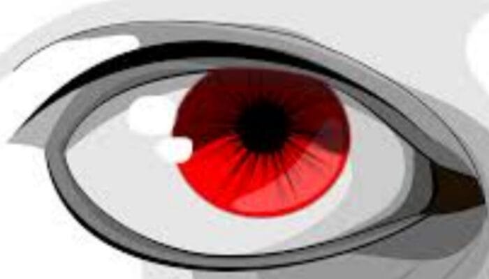 Mengatasi Mata Merah: Kenali Penyebab dan Cara Penanganannya