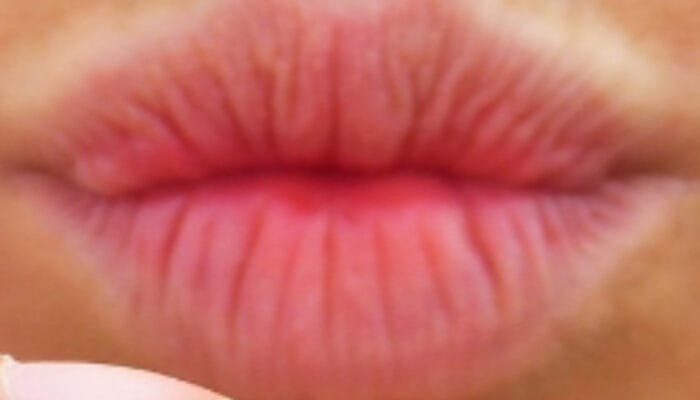 Misteri Bibir Pucat: Apa yang Sedang Terjadi pada Tubuh Anda?