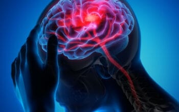 Panduan Mengatasi Migrain Sebelah Kanan yang Mengganggu