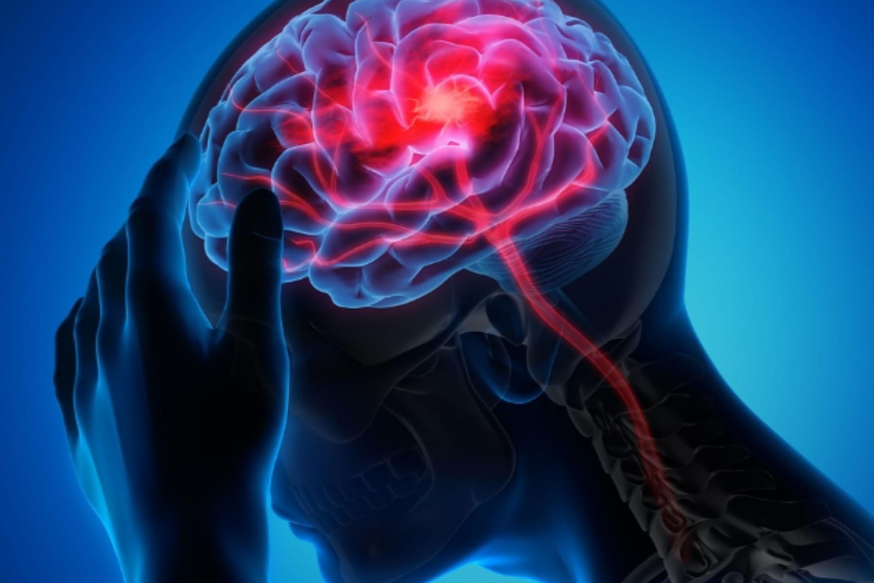 Panduan Mengatasi Migrain Sebelah Kanan yang Mengganggu