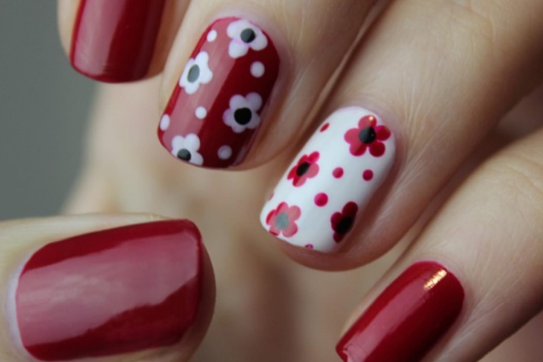 Panduan Tepat Merawat Luka Pasca Cabut Kuku