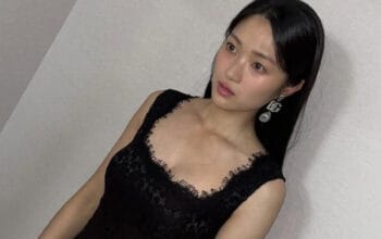 Perjuangan Pahit Kim Hye Yoon: Bertahan 7 Tahun Tanpa Agensi dan Alami Cedera