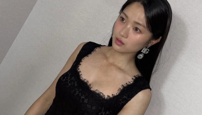 Perjuangan Pahit Kim Hye Yoon: Bertahan 7 Tahun Tanpa Agensi dan Alami Cedera