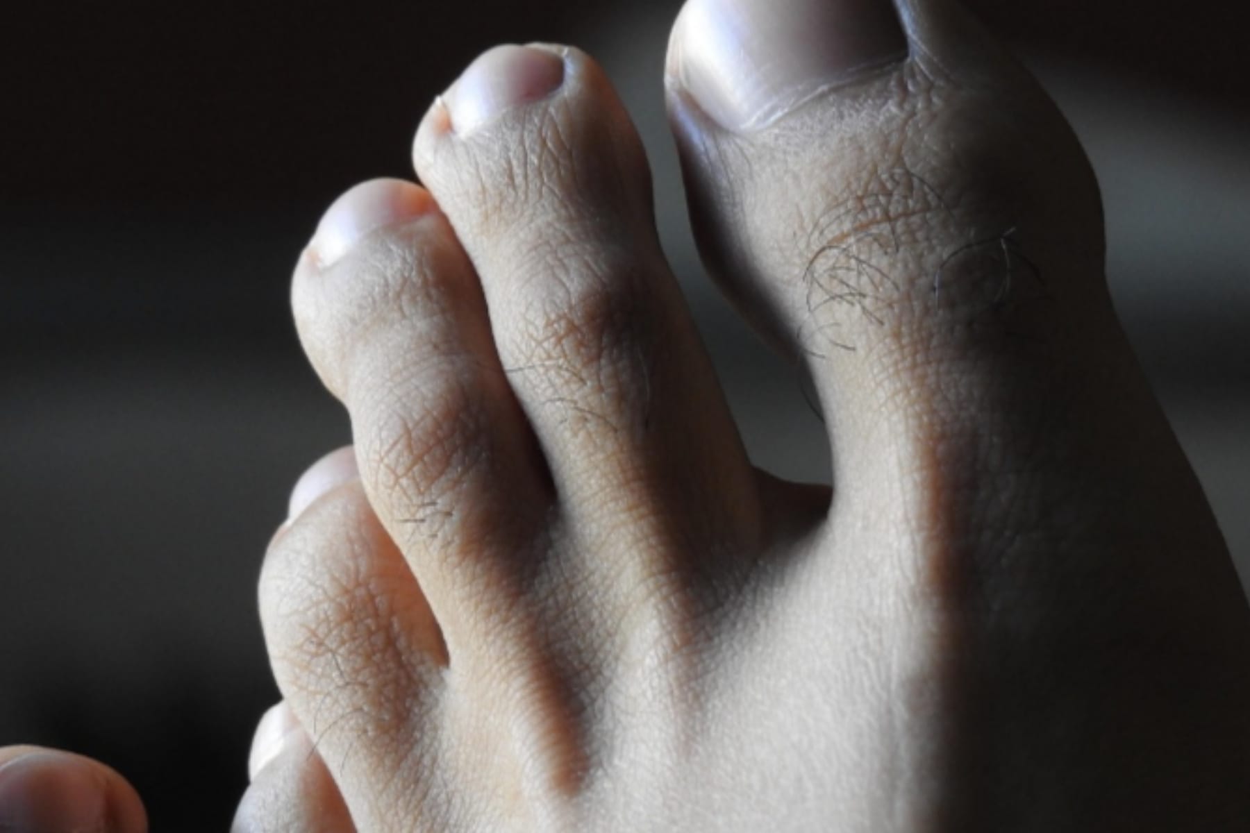 Waspada Kaki Diabetes: Kenali Tandanya Sebelum Terlambat