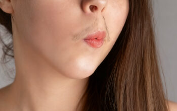 Cara Menghilangkan Kumis Tipis pada Wanita