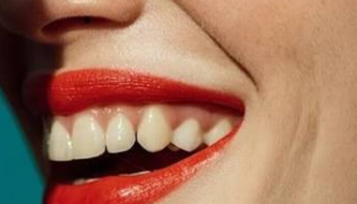 Mengatasi Gelembung Air di Bibir: Penyebab dan Penanganan