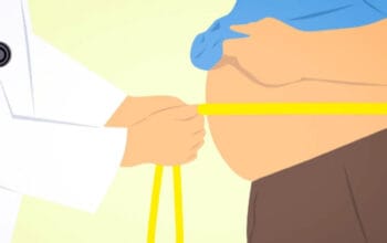 Mengenali Bahaya Perut Buncit Akibat Penyakit