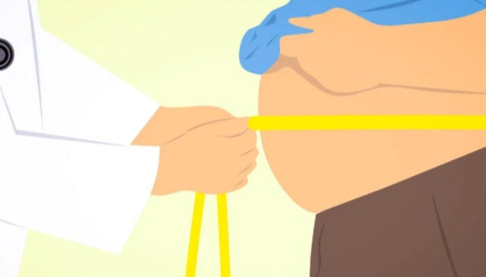 Mengenali Bahaya Perut Buncit Akibat Penyakit