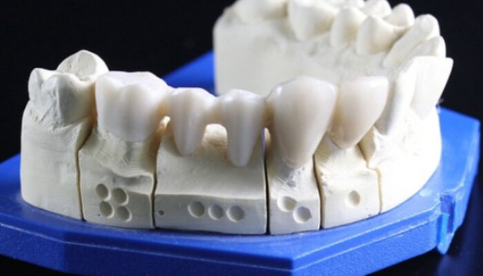 Rahasia Merawat Gigi Palsu Agar Awet dan Bebas Bau