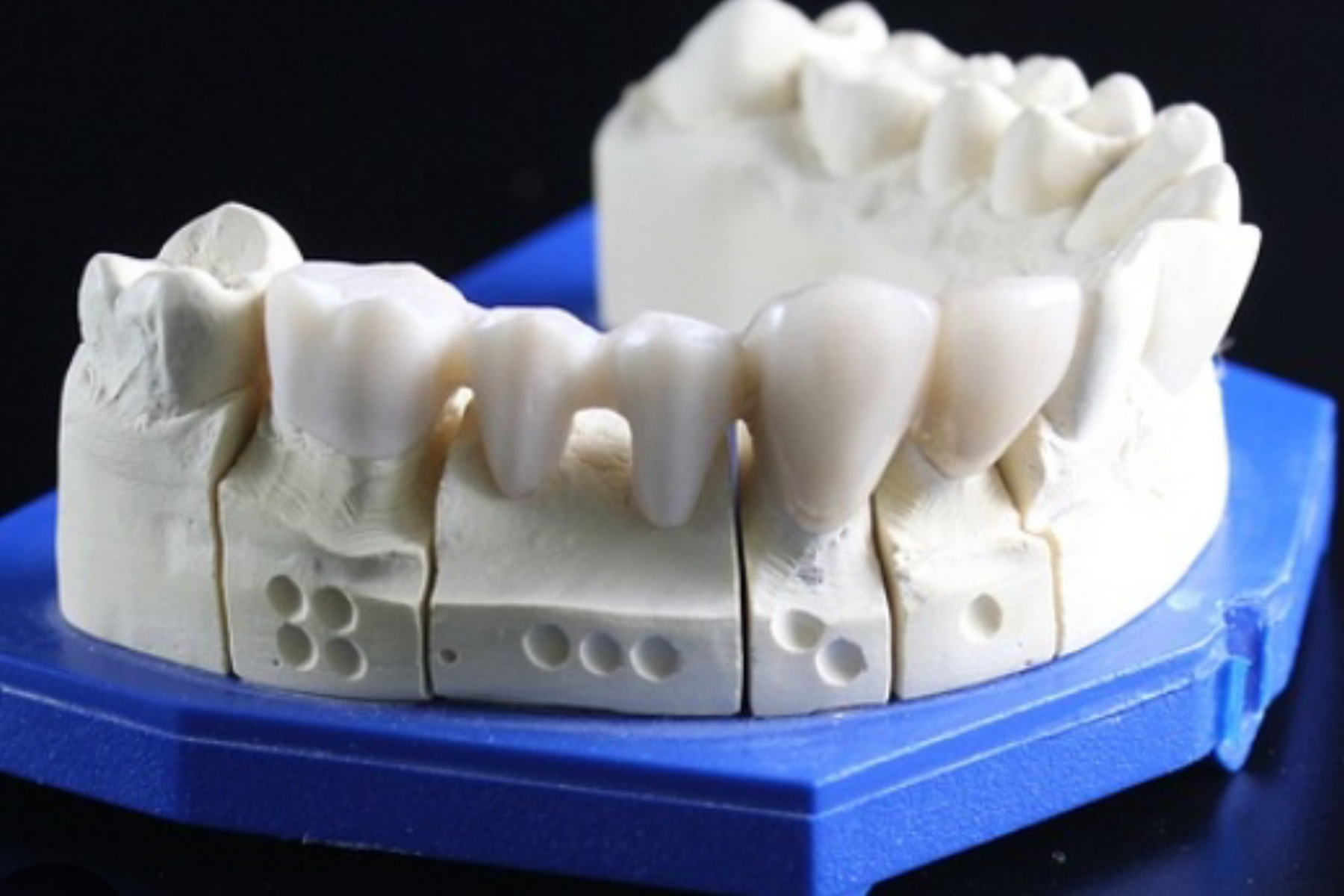 Rahasia Merawat Gigi Palsu Agar Awet dan Bebas Bau 1 Rahasia Merawat Gigi Palsu Agar Awet dan Bebas Bau