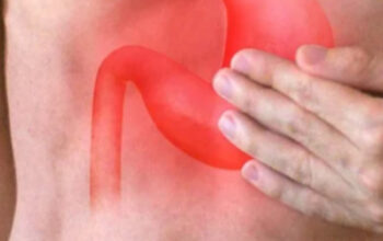 Apakah GERD Bisa Sembuh Total? Ini Faktanya 3 Apakah GERD Bisa Sembuh Total? Ini Faktanya