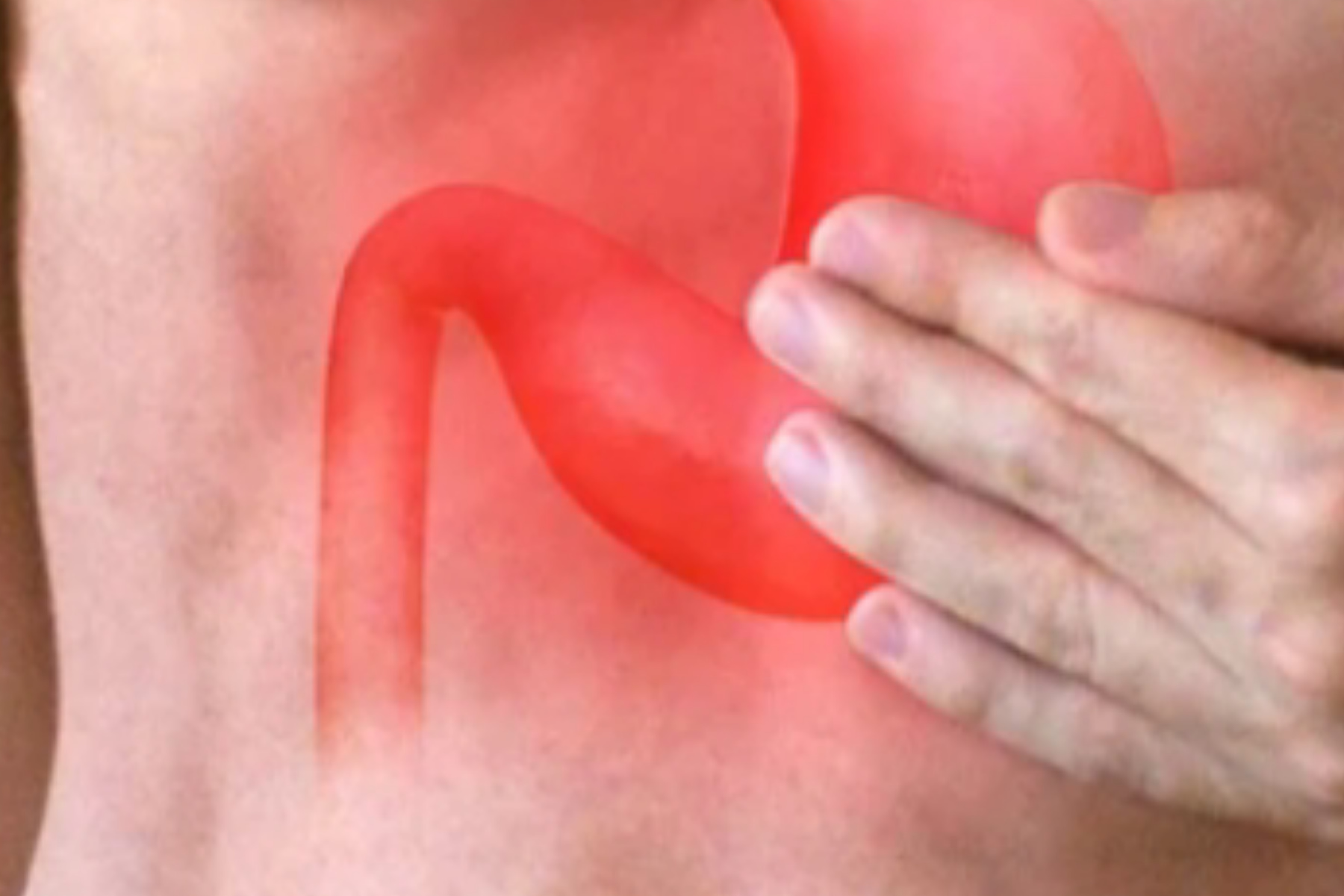 Apakah GERD Bisa Sembuh Total? Ini Faktanya