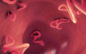 Bahaya Infeksi Cacing Mata yang Jarang Disadari