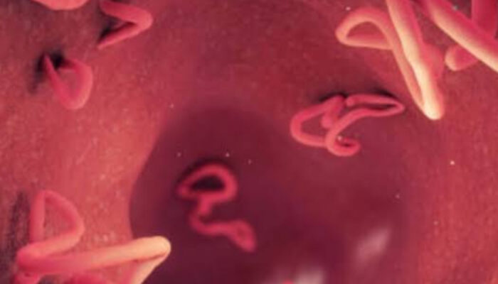 Bahaya Infeksi Cacing Mata yang Jarang Disadari