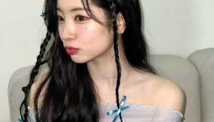 Dahyun TWICE Absen di Konser Taipei Akibat Cedera Tulang, Fokus Pemulihan Total