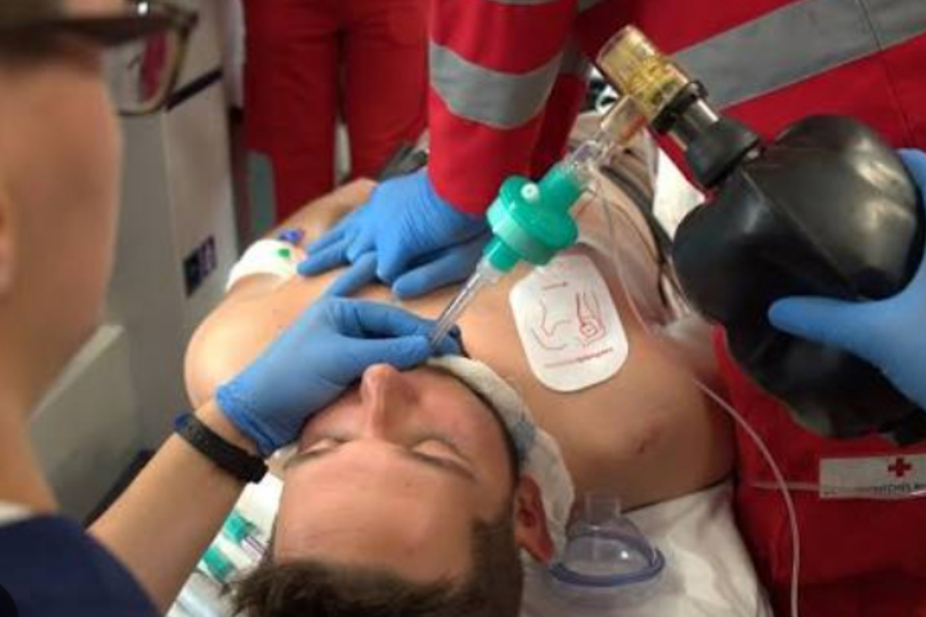 Efek Bius Total: Kenali Gejala Normal Pasca Operasi