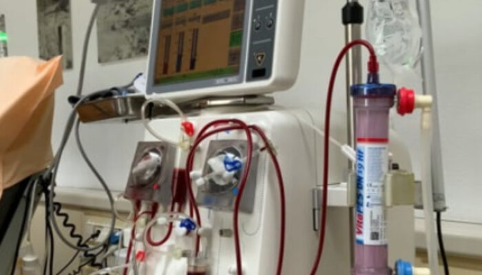 Harapan Baru Penderita Ginjal: Bisakah Berhenti Cuci Darah?