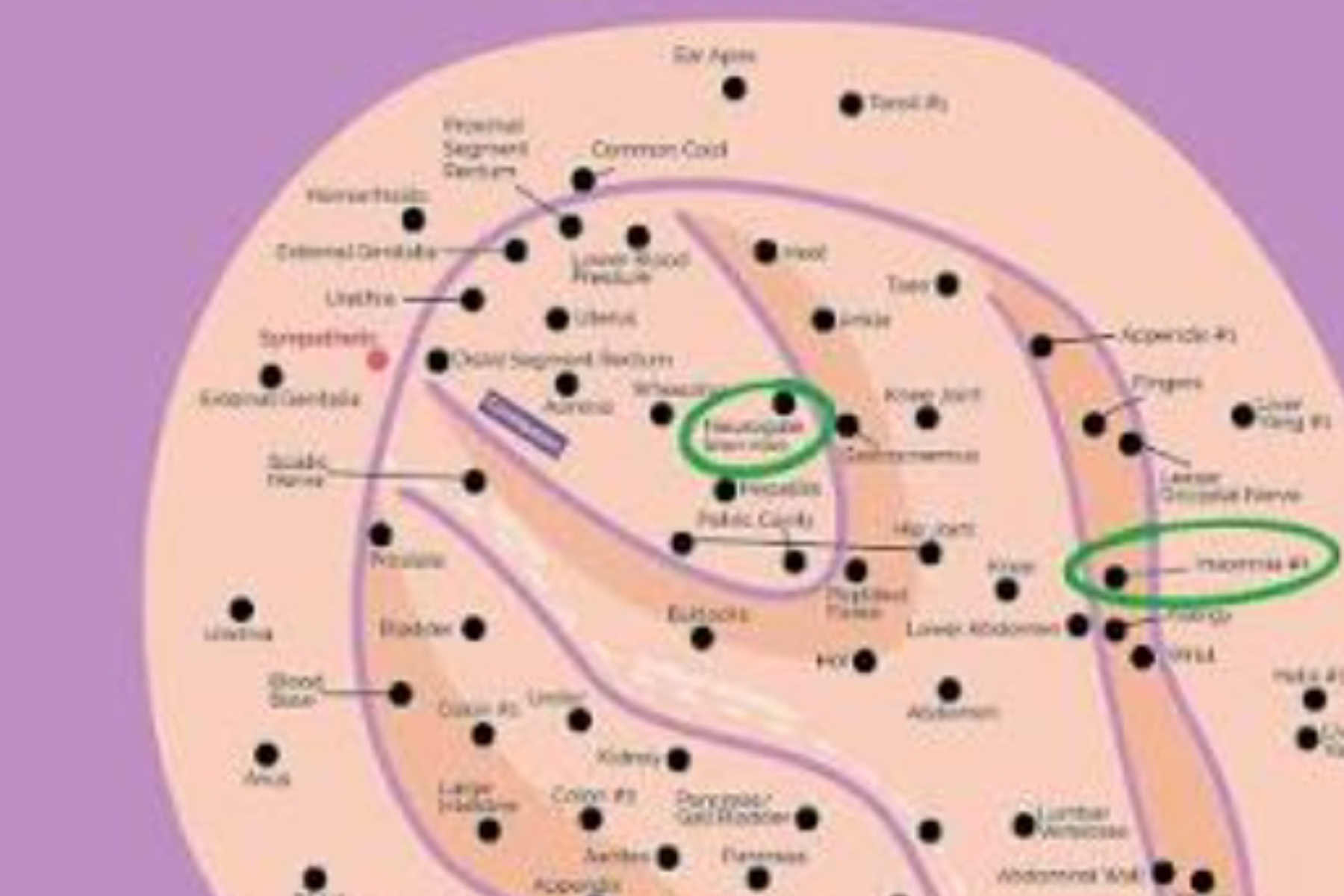 Mengenal Ear Seeds: Terapi Akupunktur Tanpa Jarum yang Viral