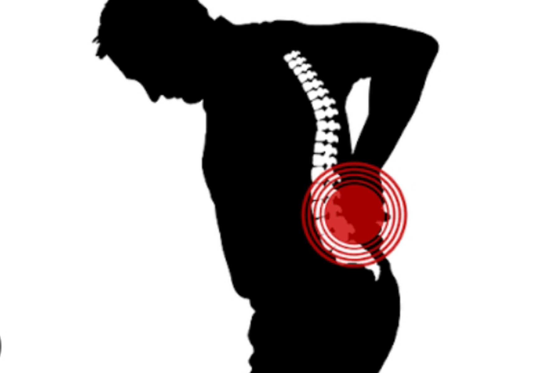 Posisi Tidur Terbaik Saat Sakit Pinggang Menyerang