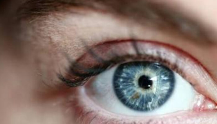 Solusi Mata Bengkak Setelah Menangis: Mengapa Hal Ini Terjadi?