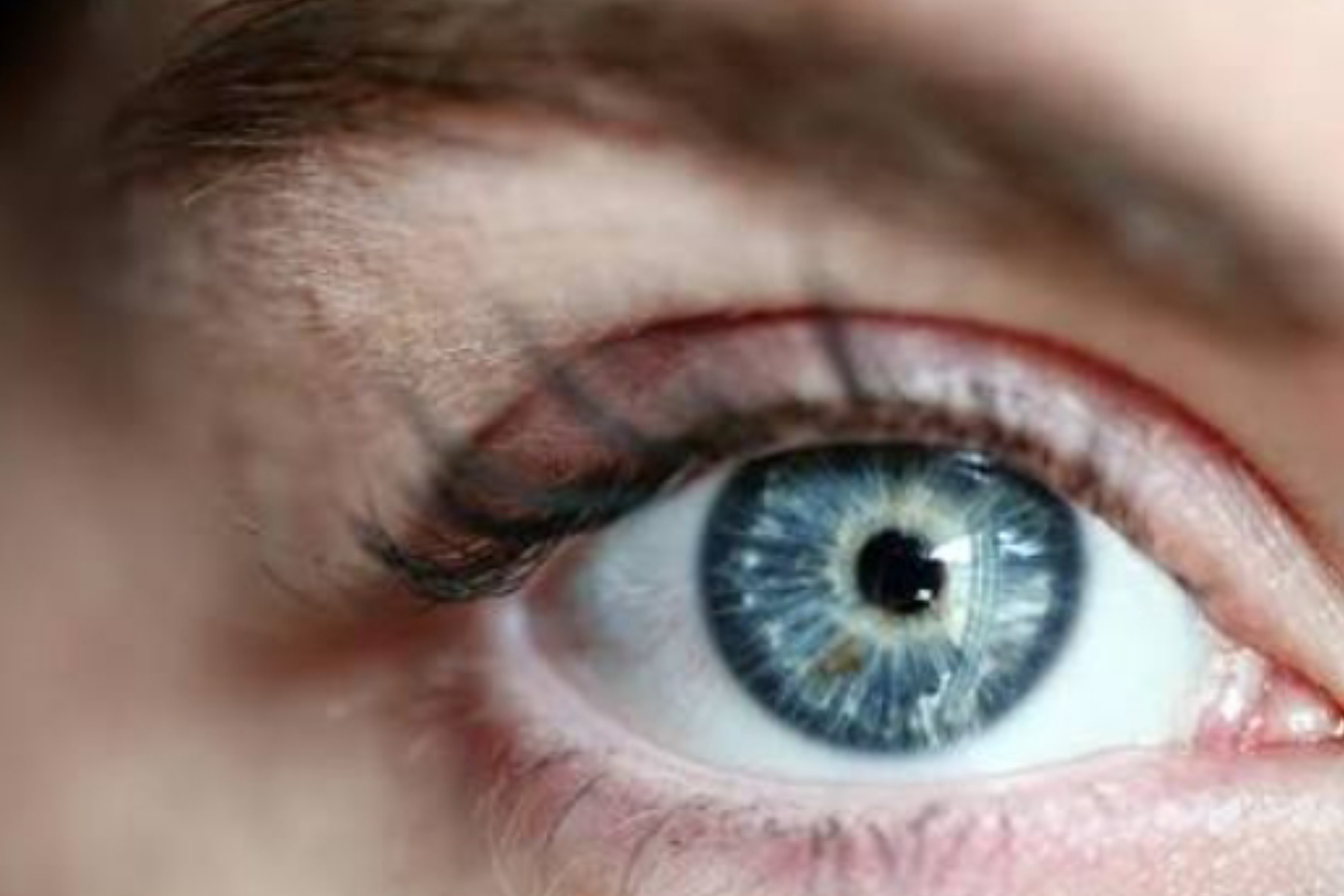 Solusi Mata Bengkak Setelah Menangis: Mengapa Hal Ini Terjadi?