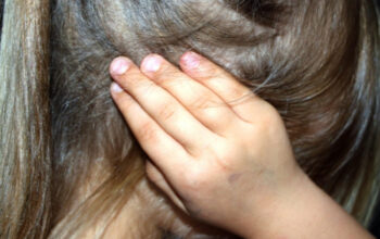 Syok Hipovolemik pada Anak: Kondisi Darurat yang Harus Diwaspadai