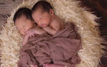 Waspada Komplikasi Hamil Bayi Kembar: Tips Tetap Tenang