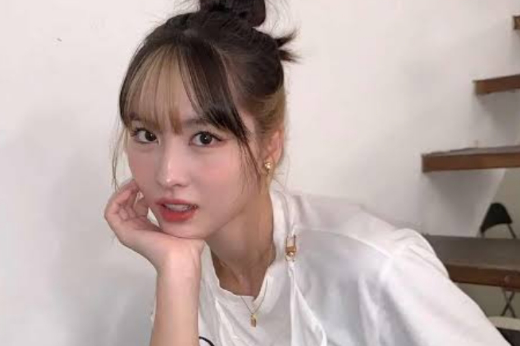 Fans Ngamuk! Momo TWICE Terpaksa Cabut Gigi Sehat Demi Jadwal Tur Dunia