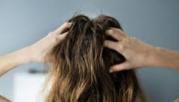 Solusi Kulit Kepala Sensitif: Cara Ampuh Atasi Gatal dan Perih