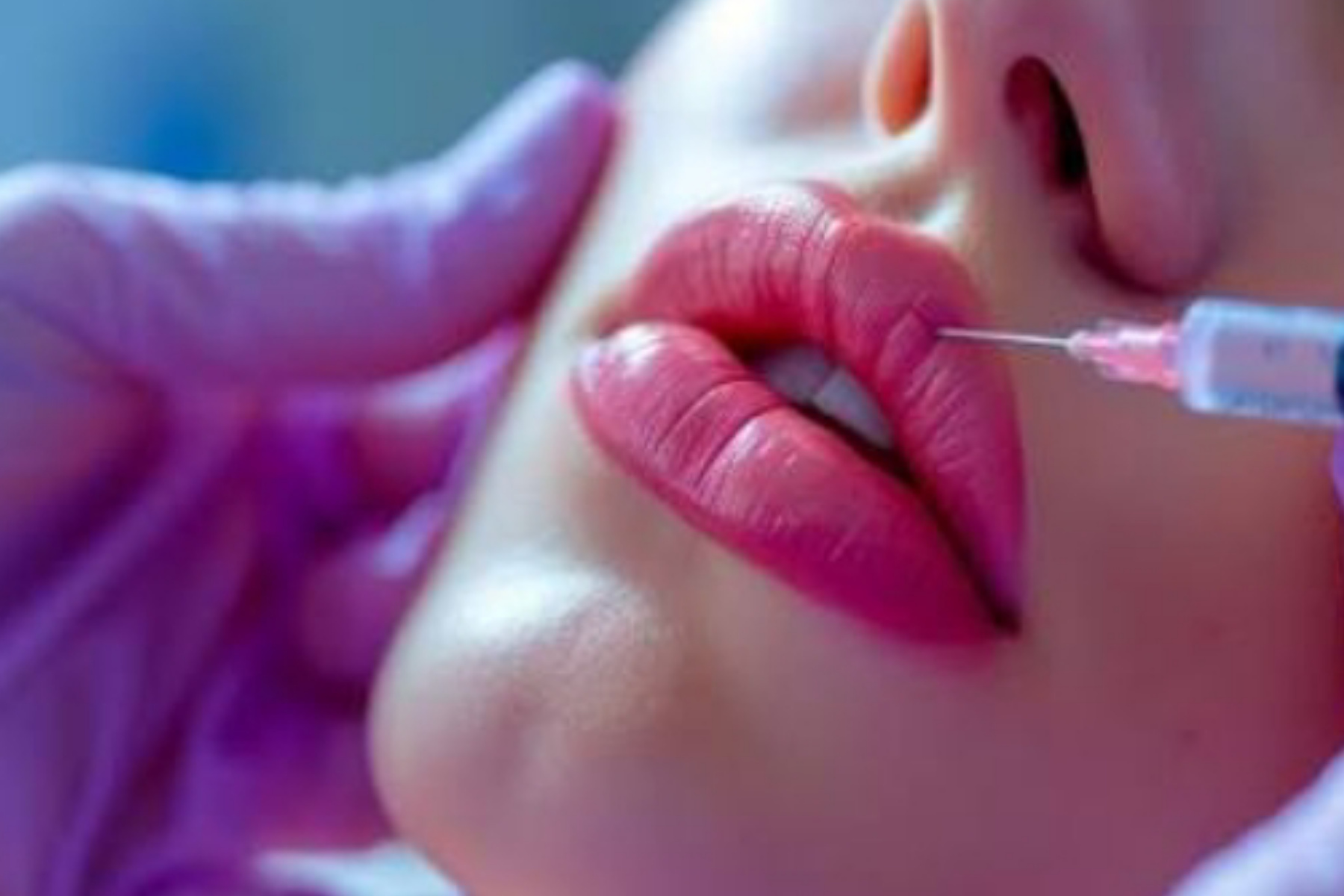 Apa Itu Baby Botox? Solusi Wajah Awet Muda Tanpa Kaku