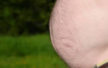 Bukan Cuma Ganggu Penampilan! Perut Buncit Beer Belly Ternyata Simpan Ancaman Penyakit Mematikan