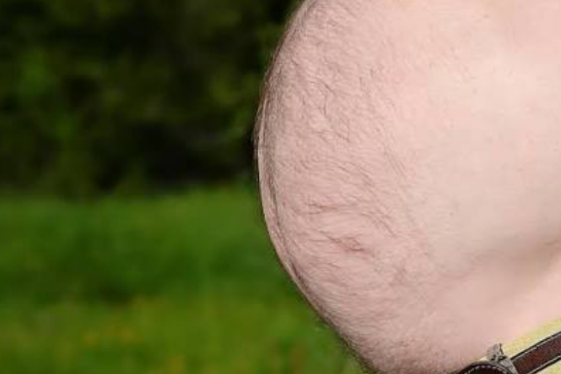 Bukan Cuma Ganggu Penampilan! Perut Buncit Beer Belly Ternyata Simpan Ancaman Penyakit Mematikan