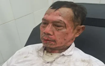 Pawai Obor Tahun Baru Islam di Purwakarta Makan Korban, Peserta Alami Luka Bakar Serius Saat Atraksi Sembur Api